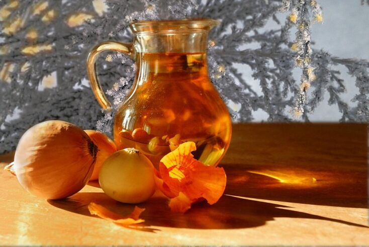 Decocción de cebola para prostatite